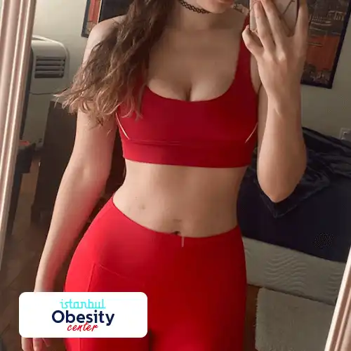 5 gastric sleeve scars