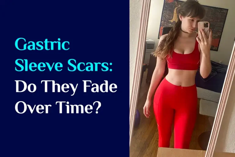 gastric sleeve scar