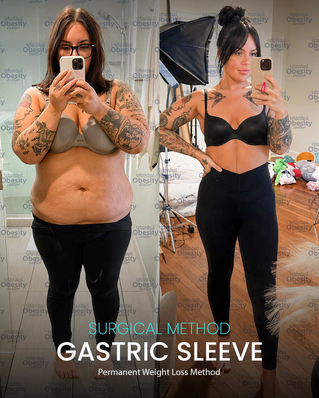 gastirc sleeve in turkey 14