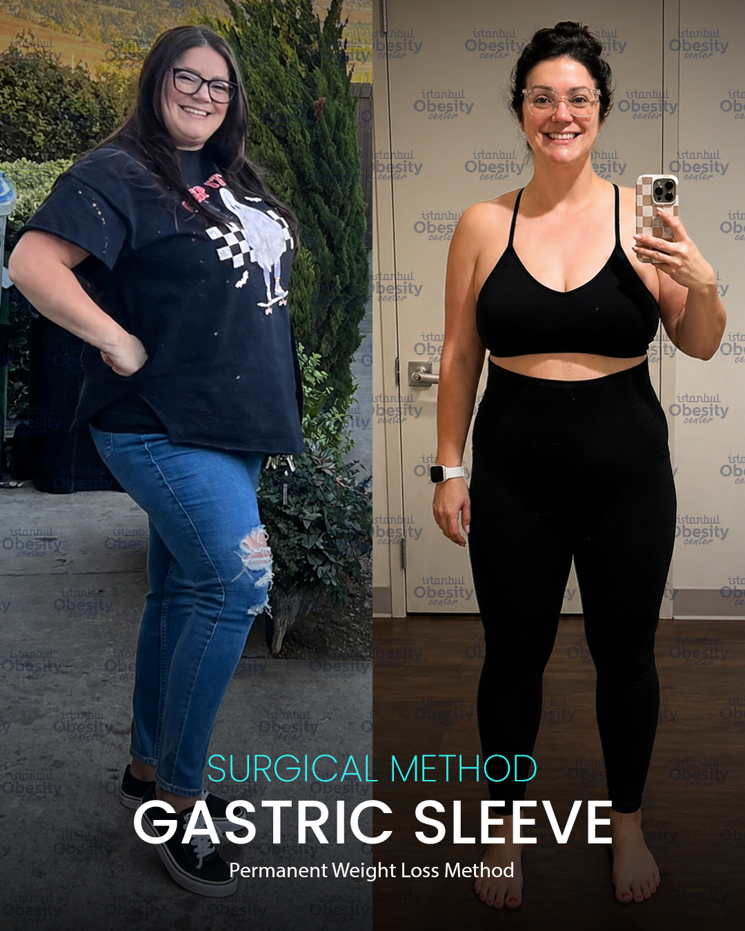 gastirc sleeve in turkey 15